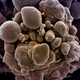 Imagen para el artículo titulado Este es el aspecto del coronavirus atacando una célula humana bajo el microscopio electrónico
